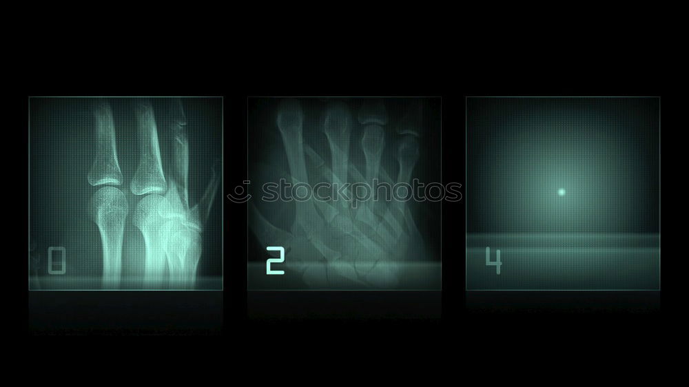 Similar – XRay X-rays Hand Doctor