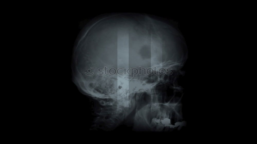 Similar – Roentgen Kopf 1 schwarz