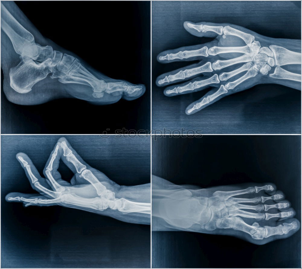 Similar – XRay X-rays Hand Doctor