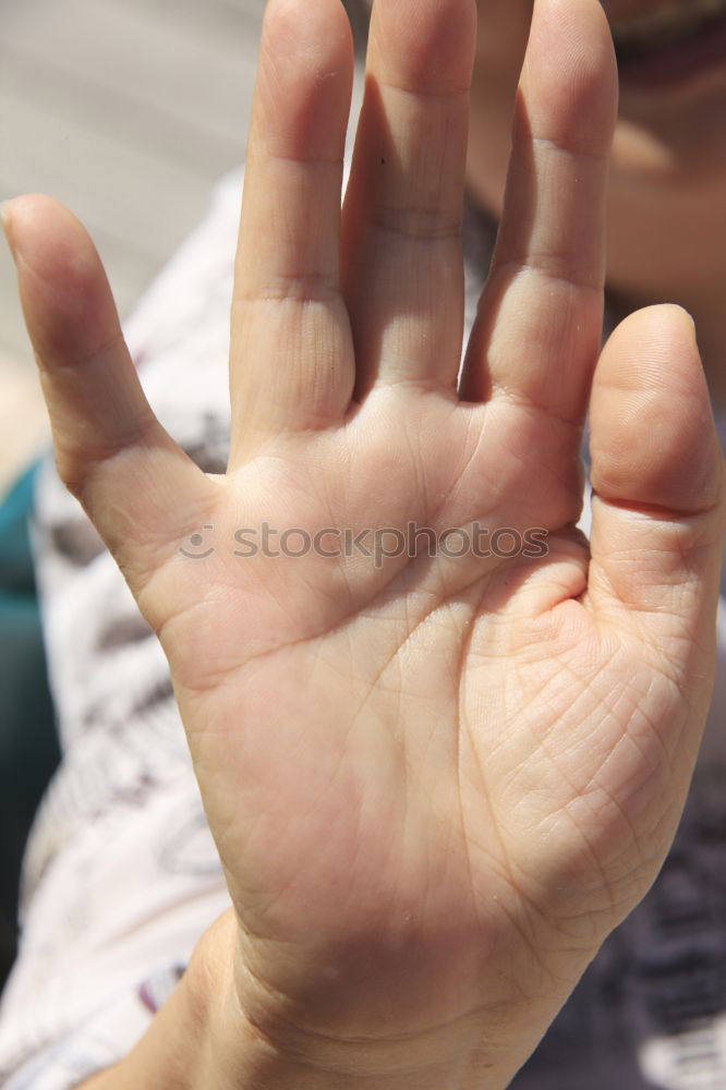 Similar – Foto Bild Mückenstich Hand