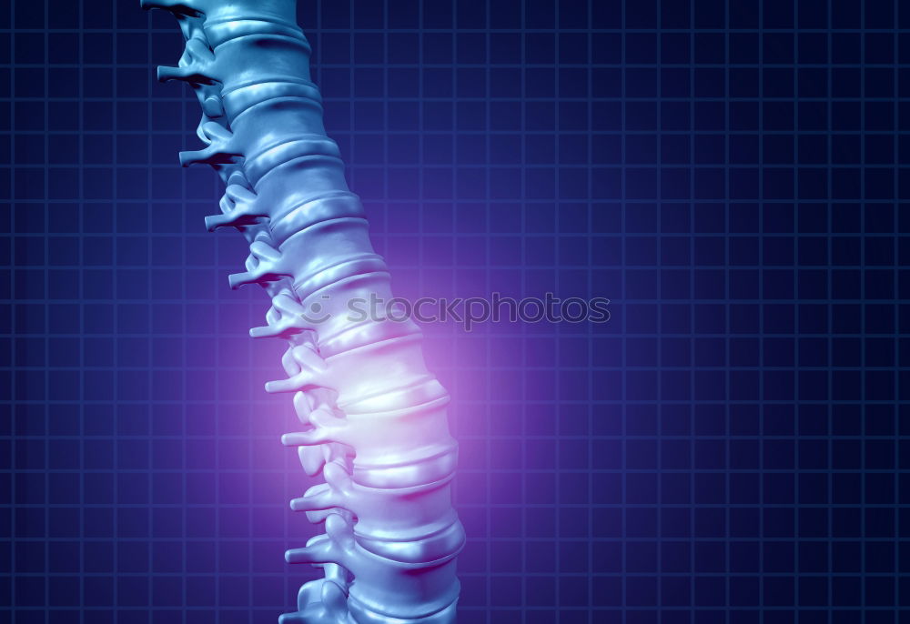 Similar – hals Wirbelsäule Rippen