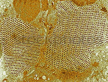 Similar – microscopic galactose crystals