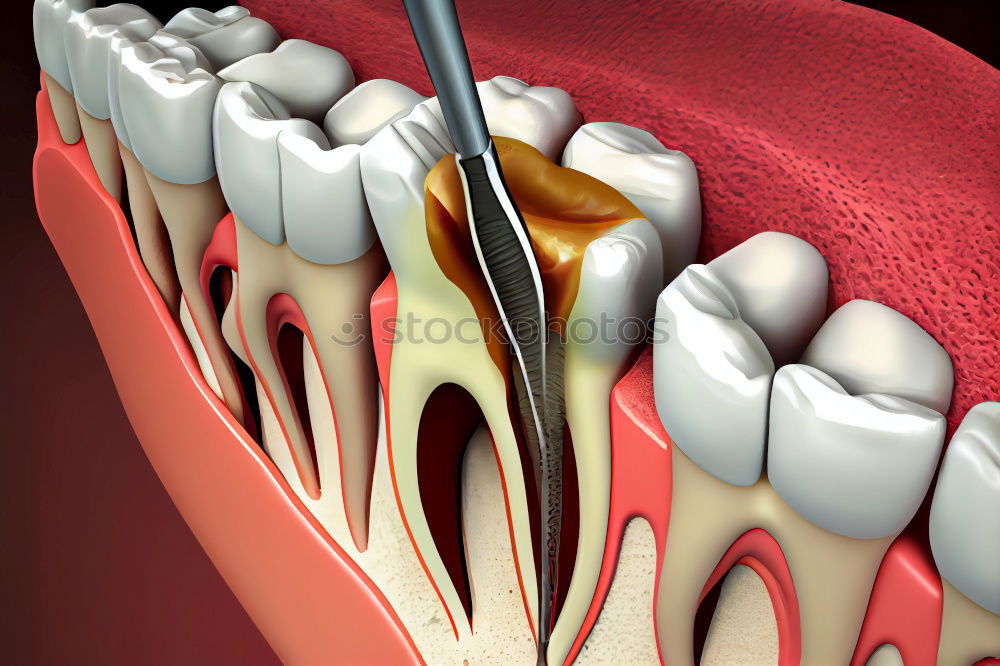 Similar – gap between one’s teeth