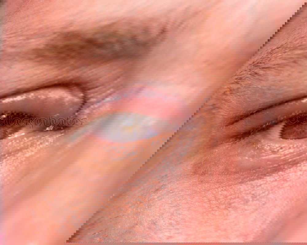 Similar – Image, Stock Photo a man with swollen eye from a bee sting