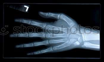 Similar – XRay X-rays Hand Doctor