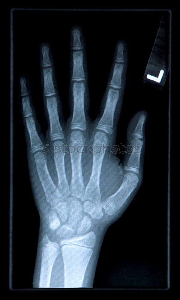 Similar – XRay X-rays Hand Doctor