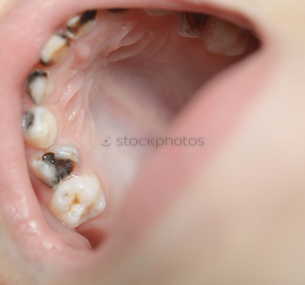 Similar – Dog teeth with braces