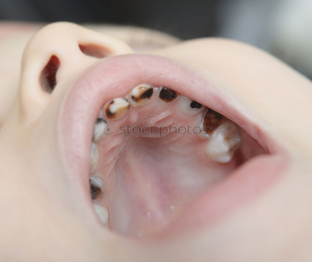 Similar – Dog teeth with braces