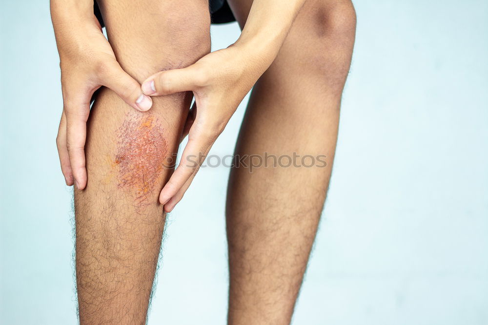 Similar – Image, Stock Photo abrasive wound Human being