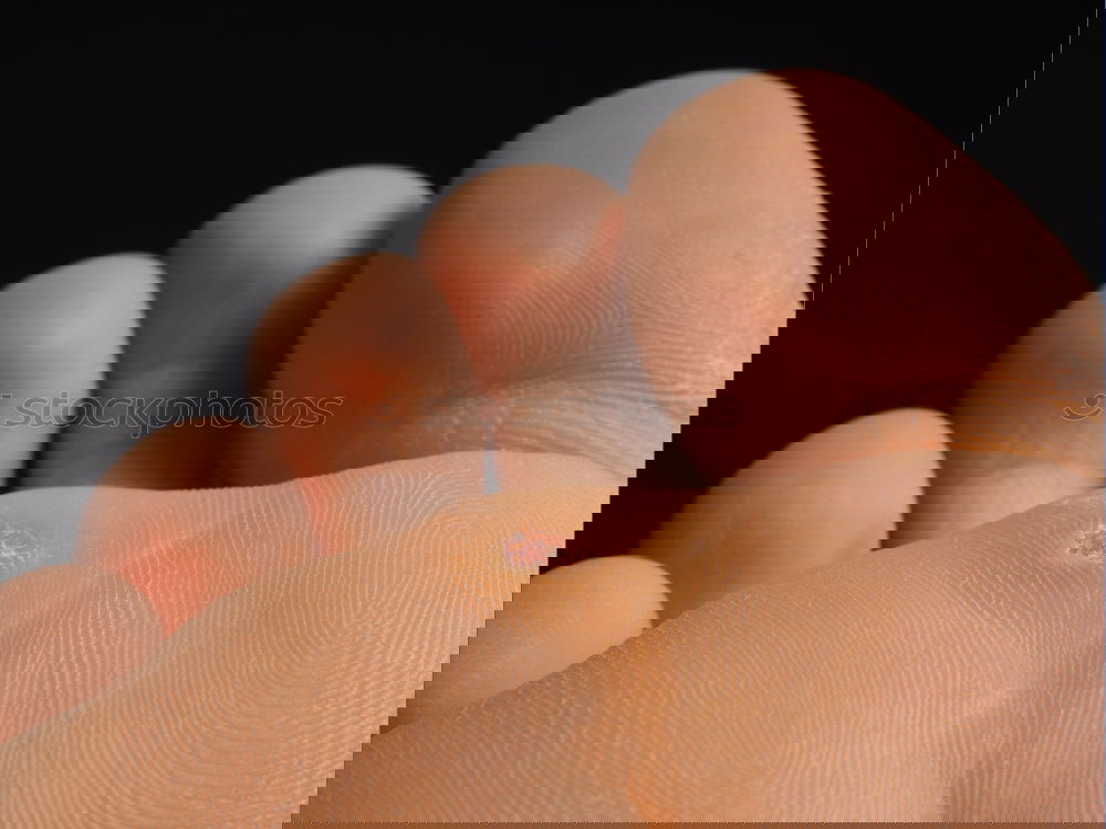 Similar – Foto Bild Mückenstich Hand