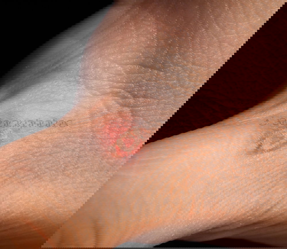 Similar – Foto Bild Narbe Stoff Hand rosa