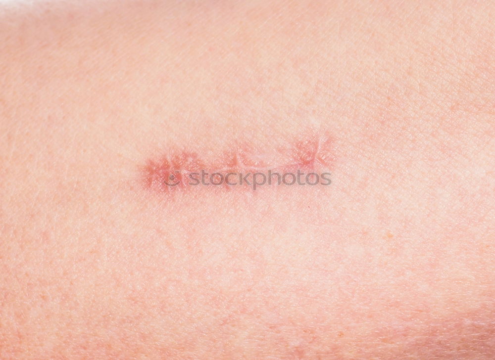 Similar – Image, Stock Photo ow Holder Stapler Wound