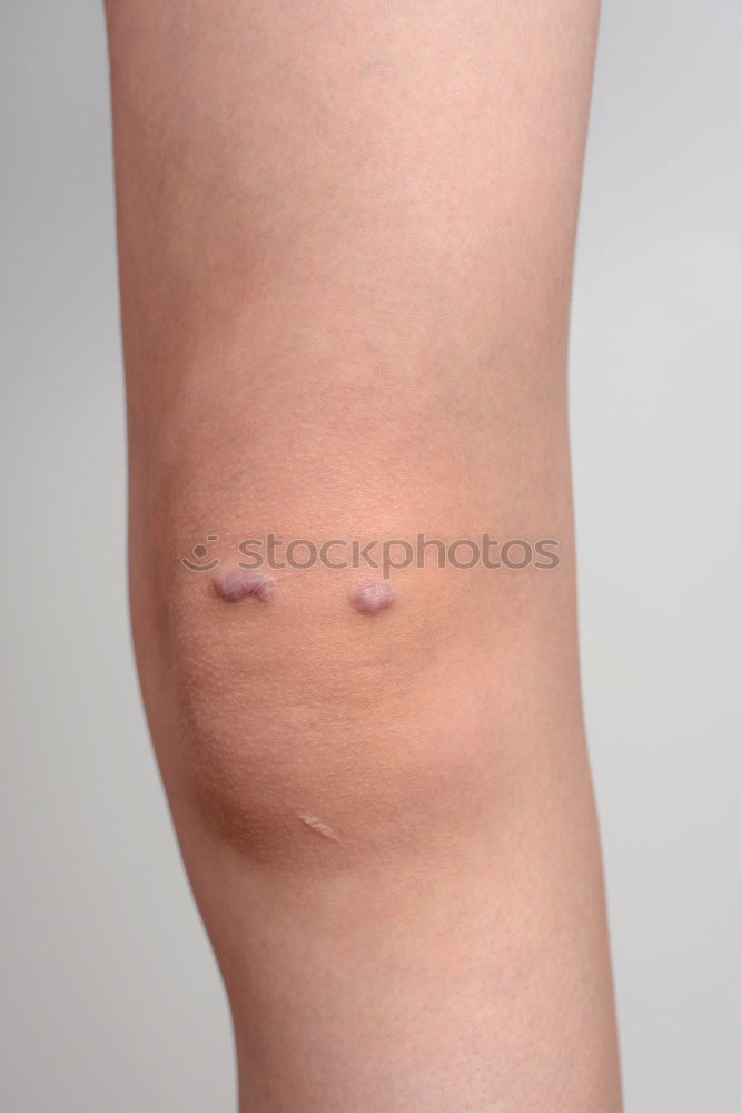 Similar – Image, Stock Photo abrasive wound Human being