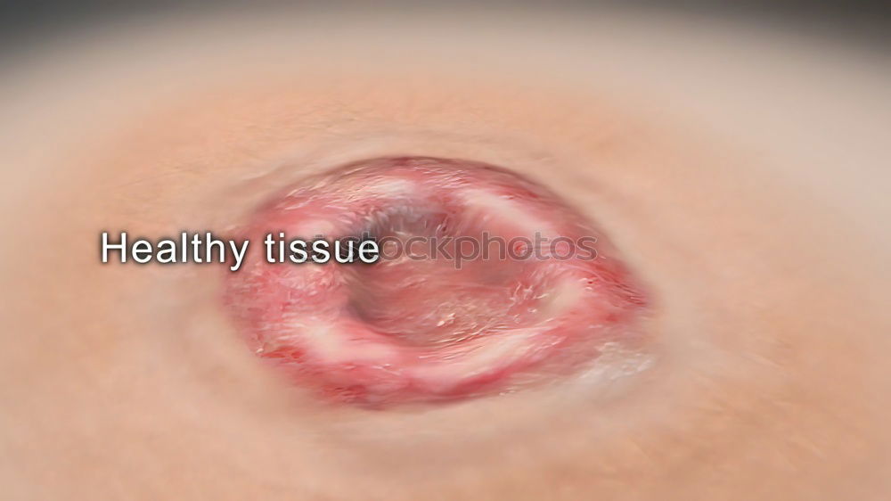 Similar – umbilicus Fluff Navel