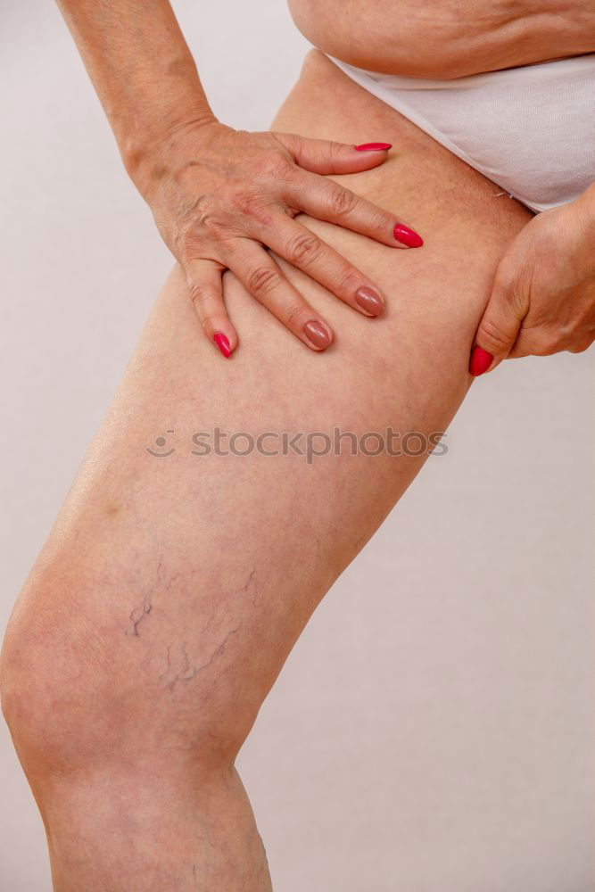 Similar – Image, Stock Photo abrasive wound Human being