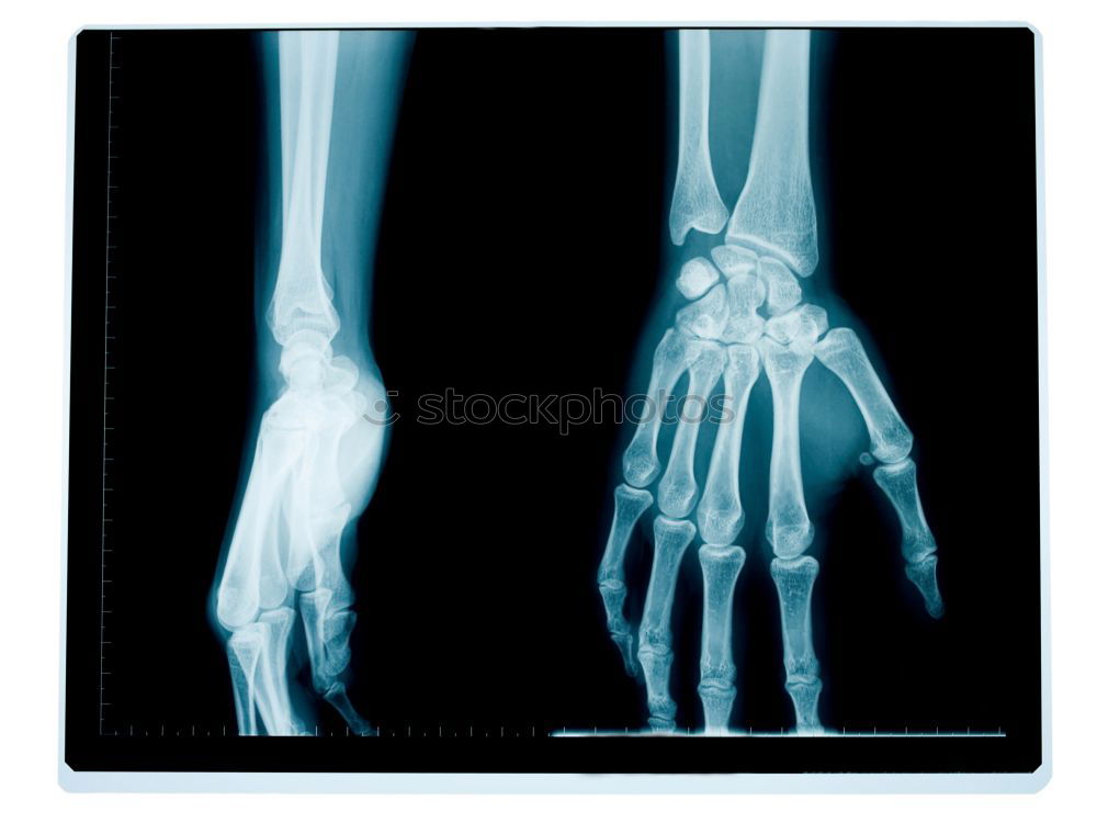 Similar – XRay X-rays Hand Doctor