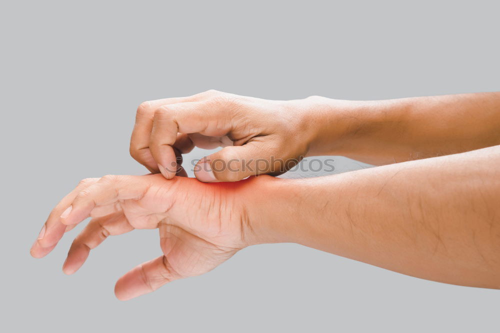 Similar – Foto Bild Mückenstich Hand