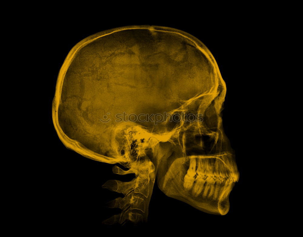 Similar – Roentgen Kopf 1 schwarz