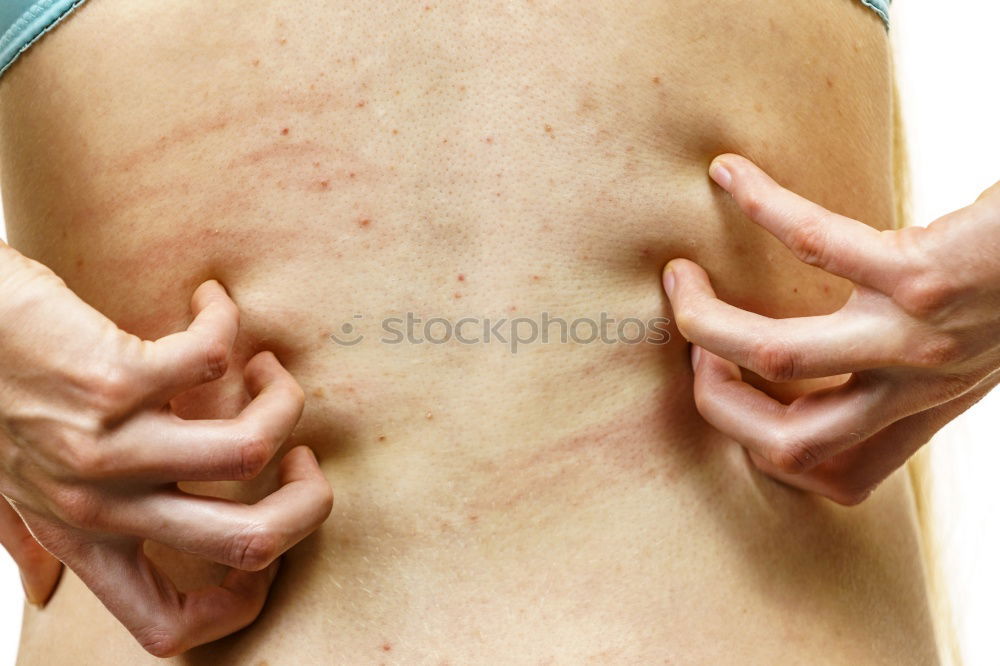 Similar – Ouch! Wound Scratch mark