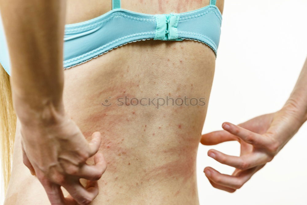 Similar – Image, Stock Photo abrasive wound Human being