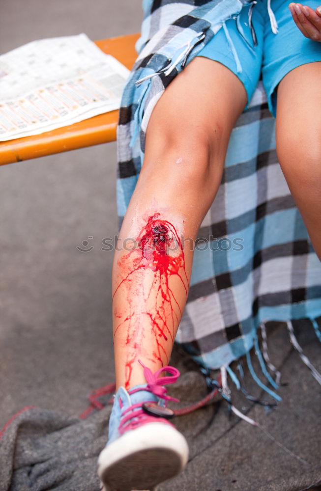 Similar – Bruise wound on child’s leg