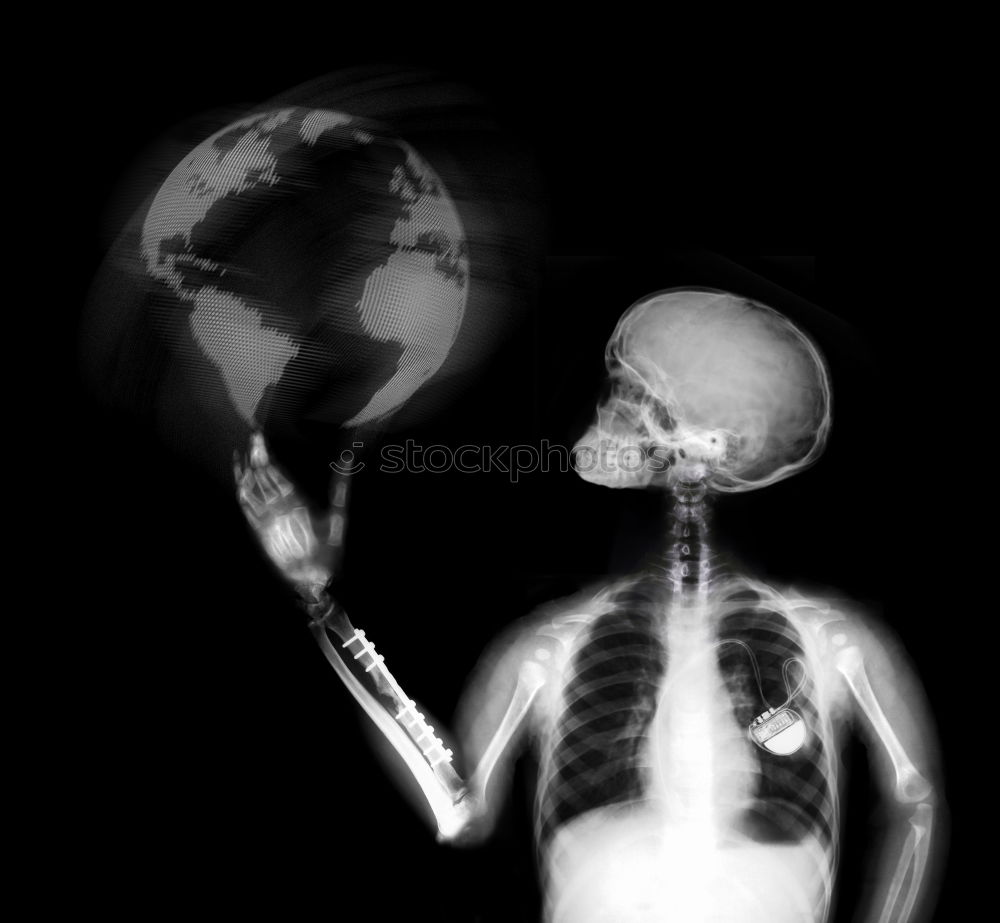 Similar – Image, Stock Photo Human skeleton X-ray examination roentgenogram