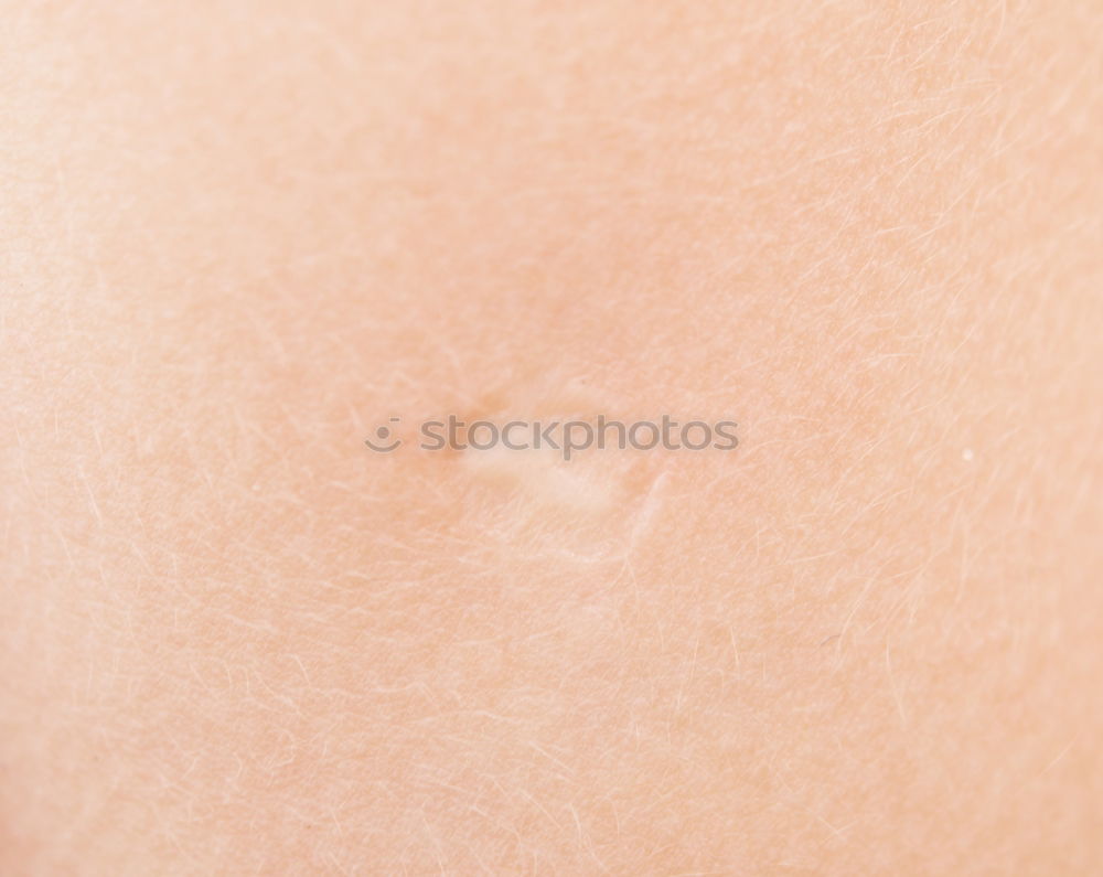 Similar – Image, Stock Photo #A# Ouch! Art Esthetic