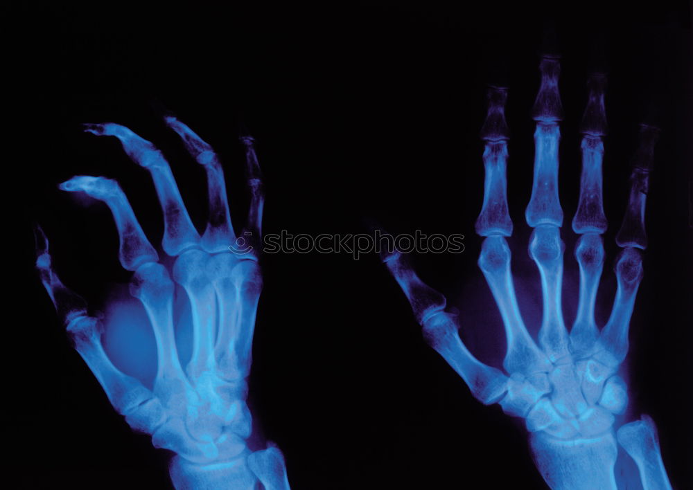 Similar – XRay X-rays Hand Doctor