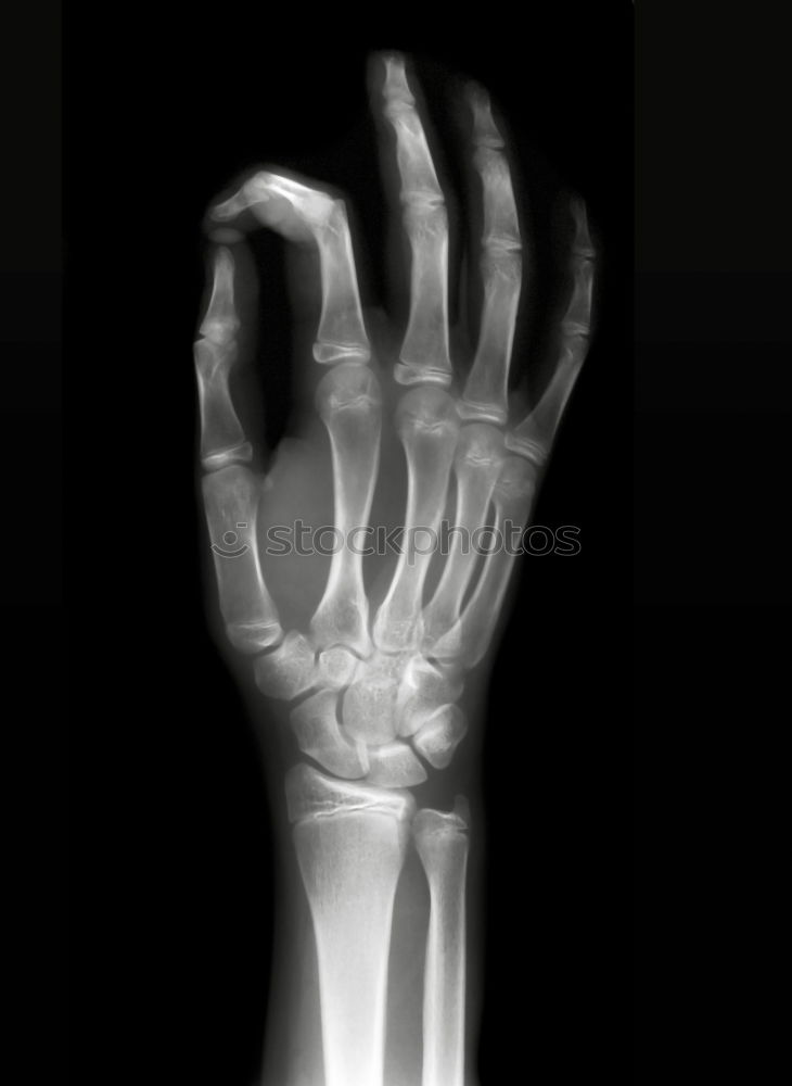 Similar – XRay X-rays Hand Doctor