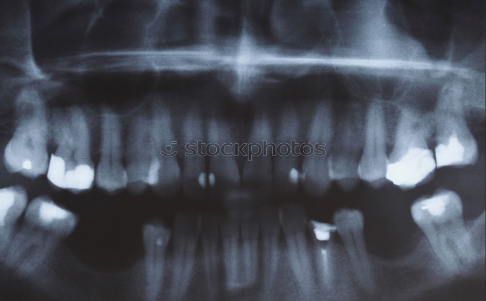 Similar – Dog teeth with braces