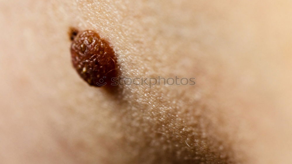 Similar – Human skin close up Body