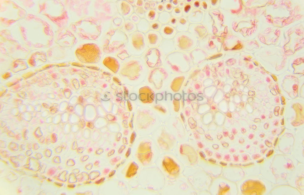 Similar – Image, Stock Photo Bell-shaped animal in transmitted light at about 400x magnification , slightly stained, you can see the vacuoles, in the surrounding area chains of rod-shaped bacteria are visible.