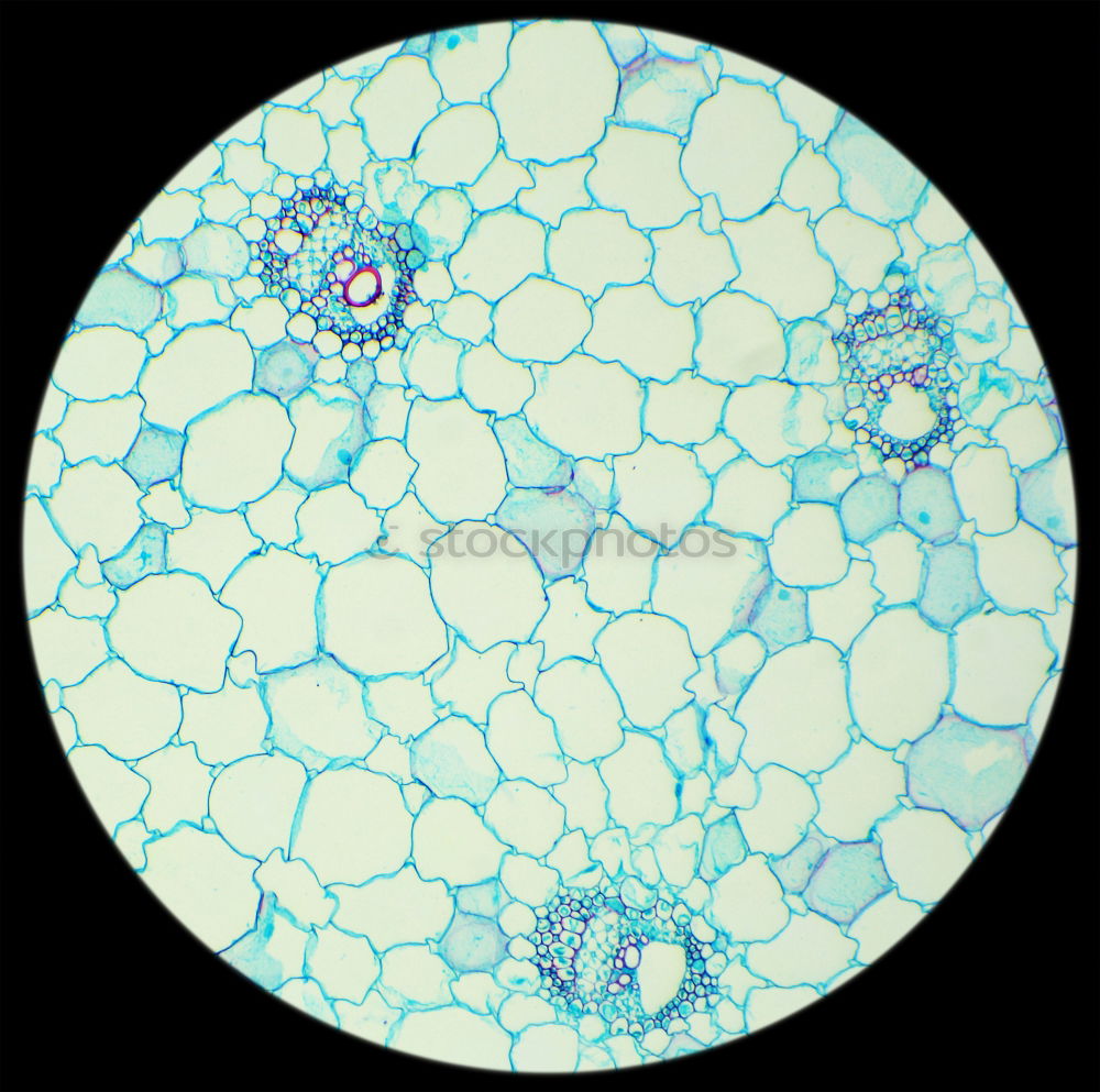 Similar – spherical algae, Volvox aurea under the microscope