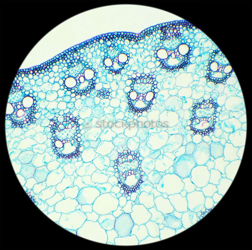 Similar – Image, Stock Photo Bell-shaped animal in transmitted light at about 400x magnification , slightly stained, you can see the vacuoles, in the surrounding area chains of rod-shaped bacteria are visible.