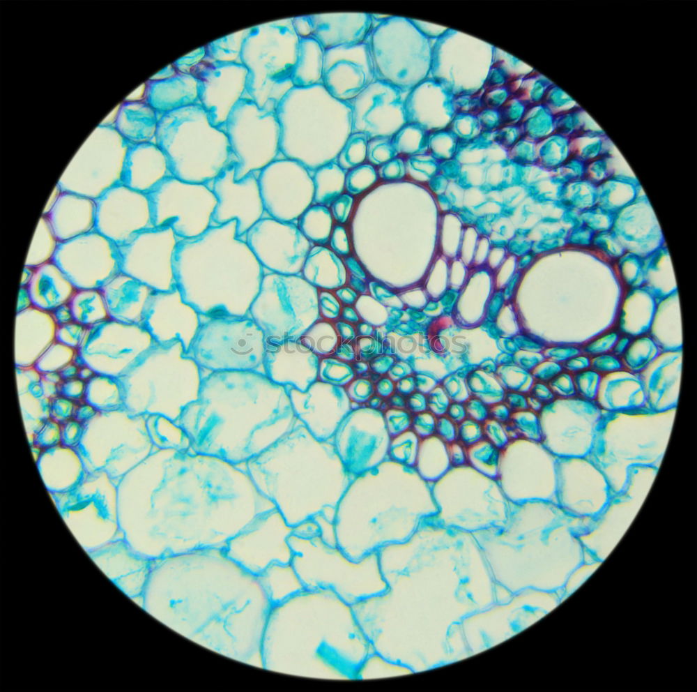 Similar – spherical algae, Volvox aurea under the microscope