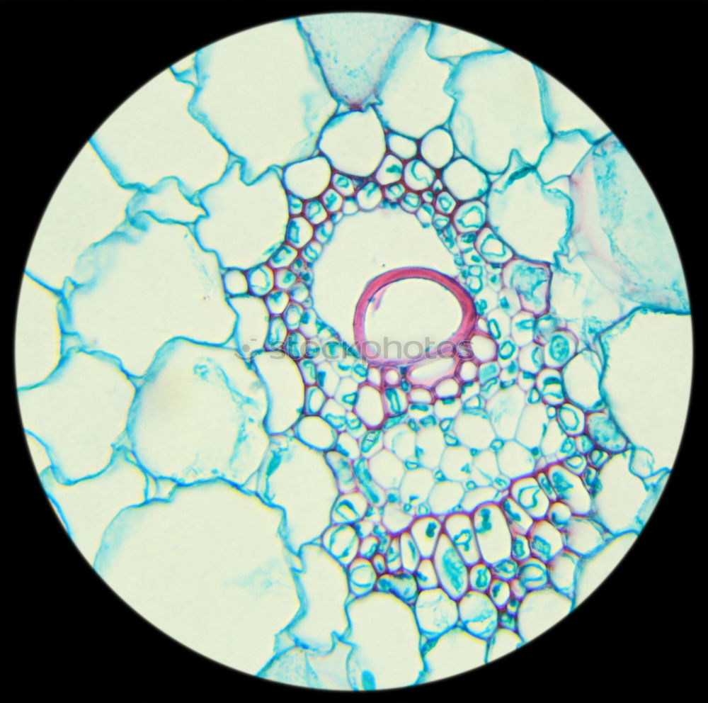 Similar – spherical algae, Volvox aurea under the microscope