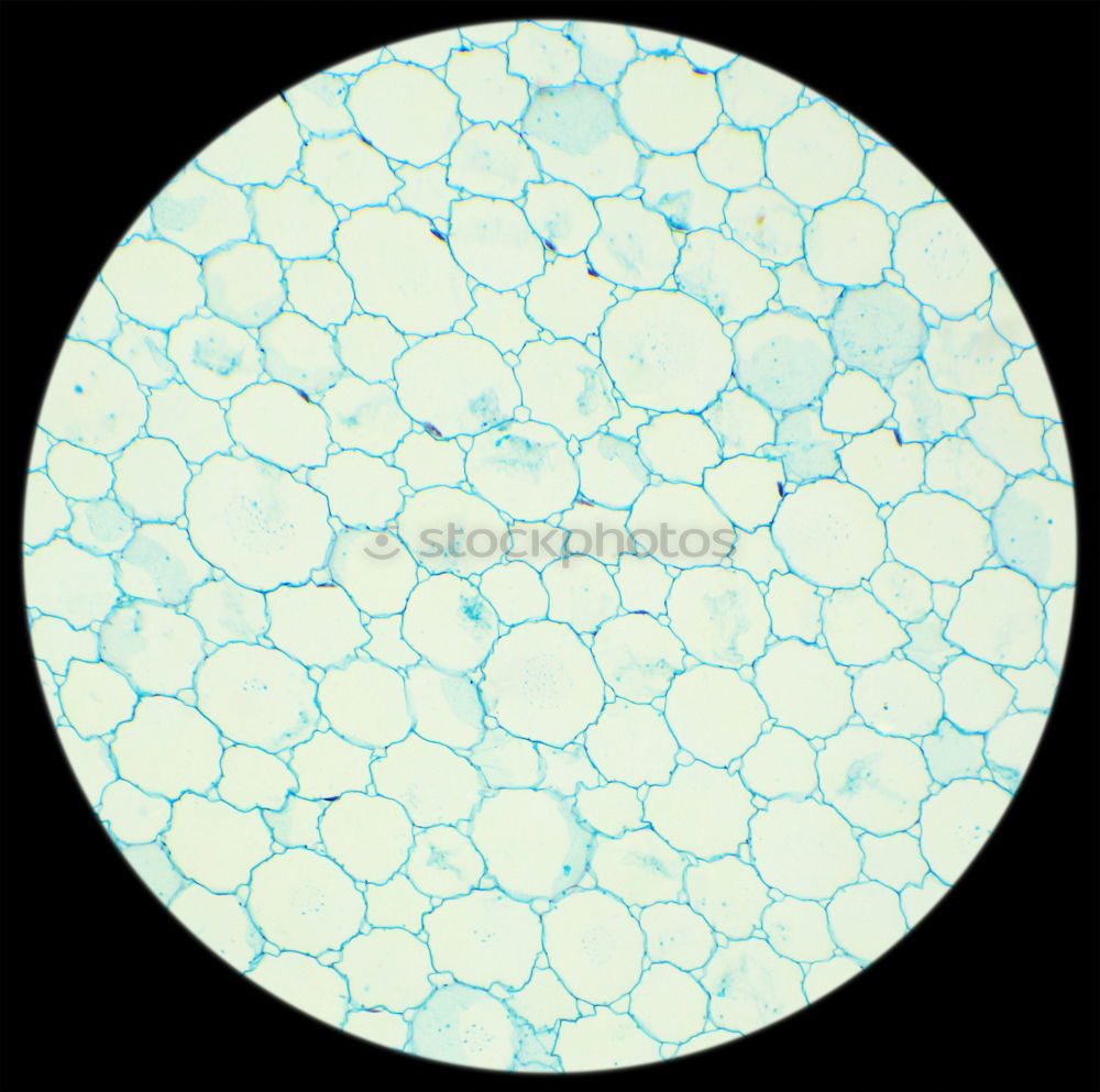 Similar – spherical algae, Volvox aurea under the microscope