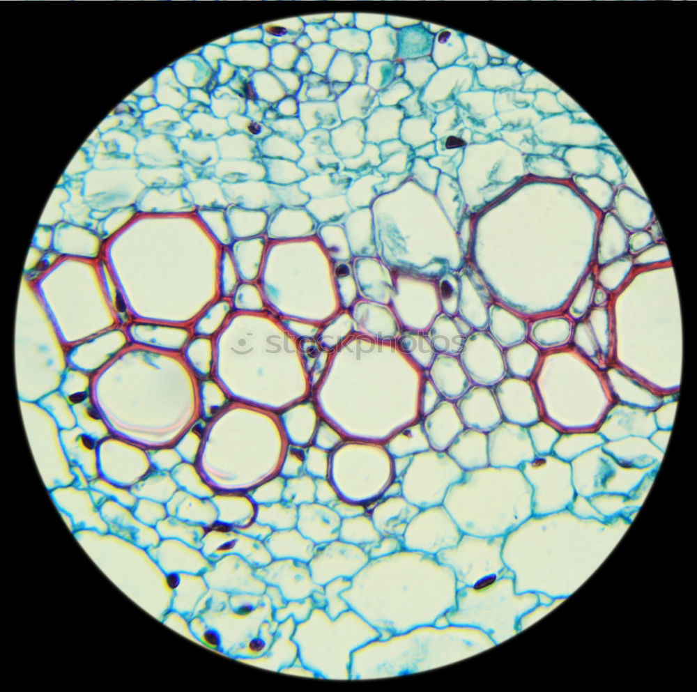 Similar – spherical algae, Volvox aurea under the microscope