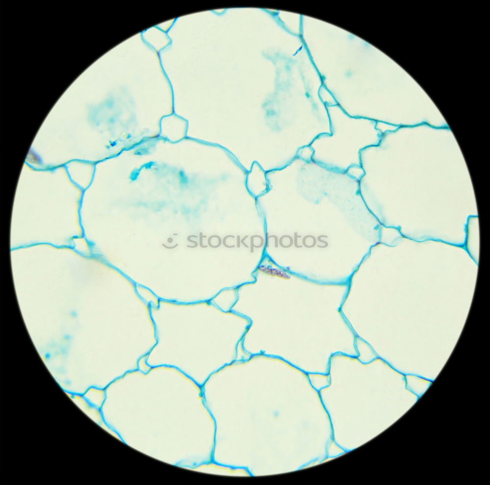 Similar – spherical algae, Volvox aurea under the microscope