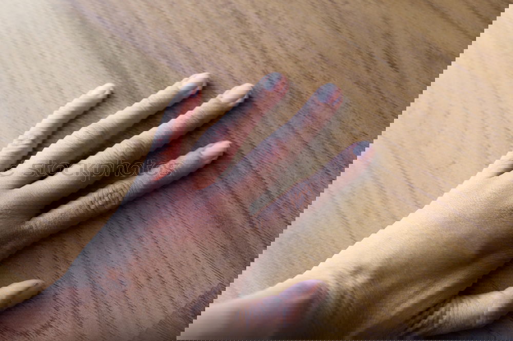 Similar – Foto Bild Mückenstich Hand