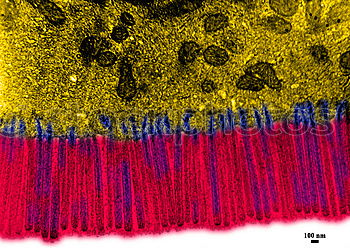 Similar – microscopic galactose crystals