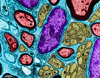 Similar – microscopic galactose crystals