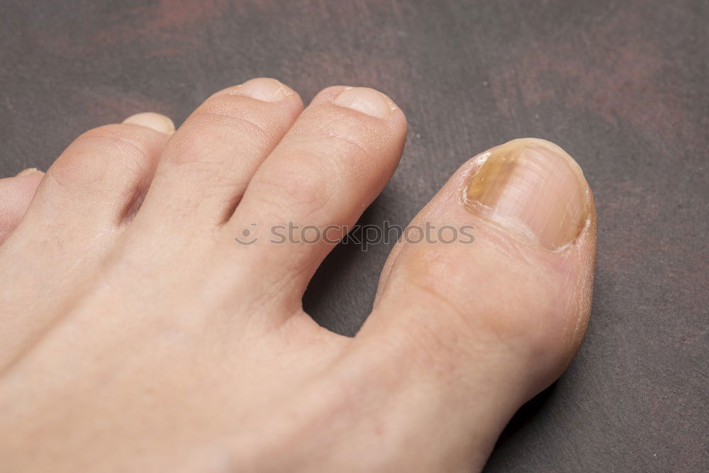 Similar – Image, Stock Photo collateral damage Toes