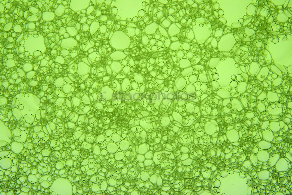 Similar – spherical algae, Volvox aurea under the microscope