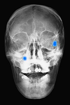 Similar – Roentgen Kopf 1 schwarz