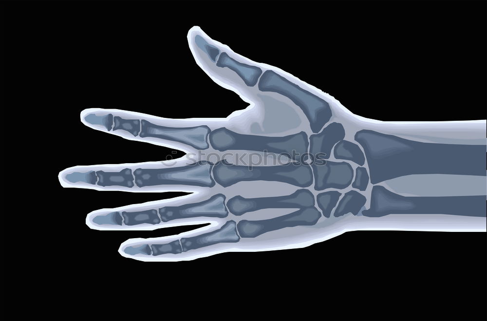 Similar – XRay X-rays Hand Doctor