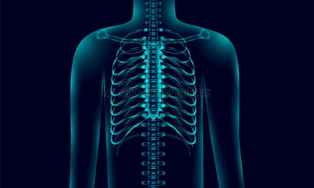 Similar – hals Wirbelsäule Rippen